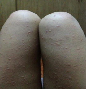 /